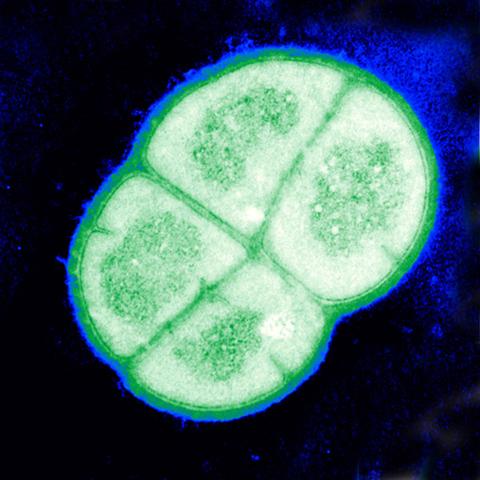 Deinococcus radiodurans (Small).jpg