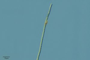 Fotomicrografia da Cianobactéria Spirulina sp. Fonte: Proyecto Agua