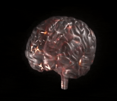 Animação de um cérebro humano, simulando as sinapses, que se dão através de impulsos elétricos.