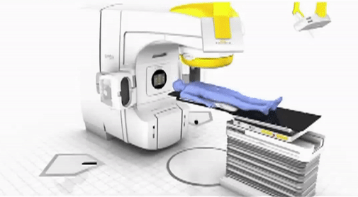 Funcionamento de um acelerador linear de particulas em radioterapia. Gif gerado a partir de um vídeo do canal do Ministério da Saúde.