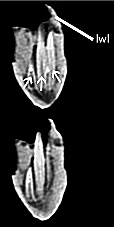 CT Scan do dentário de Brasilotitan, mostrando um dos alvéolos dentários com três dentes inseridos.