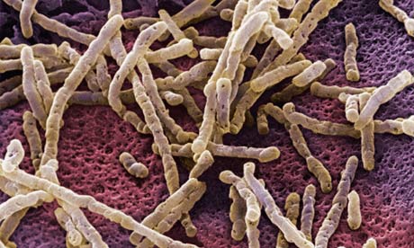 Clostridium difficile (C diff)