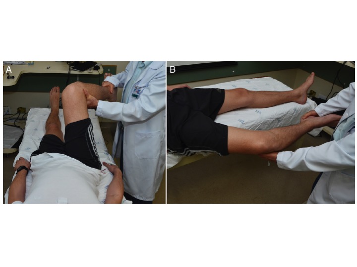 Impacto Da Artroscopia Do Quadril Na Prevencao Da Artrose Femur