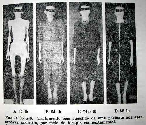 20090920_anorexia.jpg