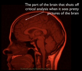 20102802_brain.jpg