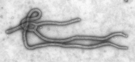 Ebola – um vírus realmente letal