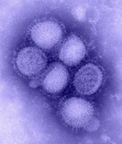 Influenza A (H1N1), a gripe do politicamente correto