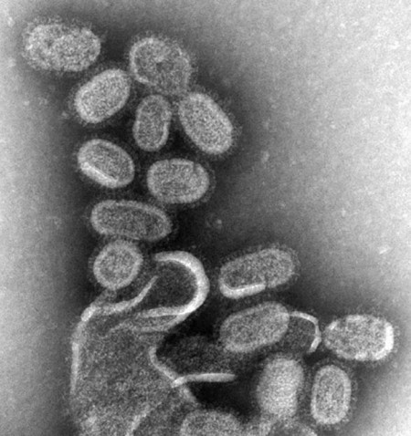 H1N1 resistente ao Tamiflu