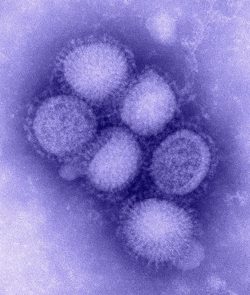 O que você precisa saber sobre o H1N1 e vacinas