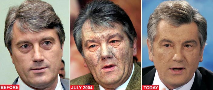 yushchenko.jpg